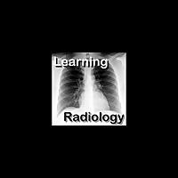 LearningRadiology Video Podcasts