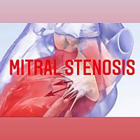 Mitral Stenosis
